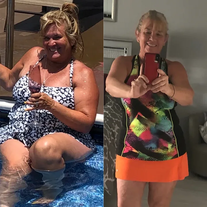 Melinda — before and after